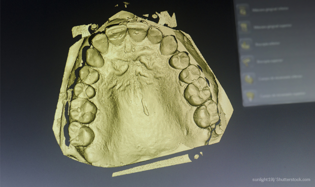 How digital dentistry and 3D printing are changing dentures