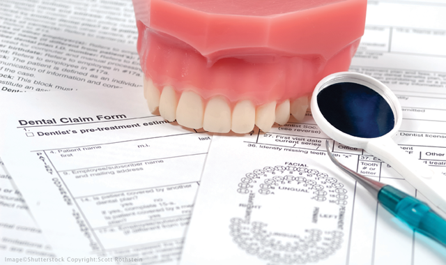 4 benefits of using gingival inflammation code D4346