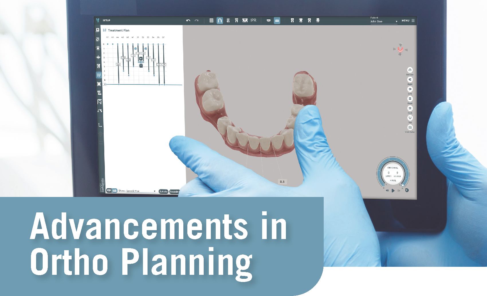 Advancements in Ortho Planning - SoftSmile ebook