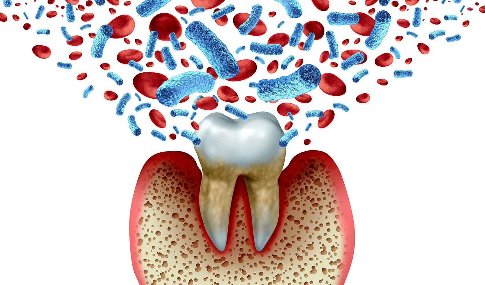 3D illustration of a tooth surrounded by bacteria | Image Source: © freshidea / stock.adobe.com