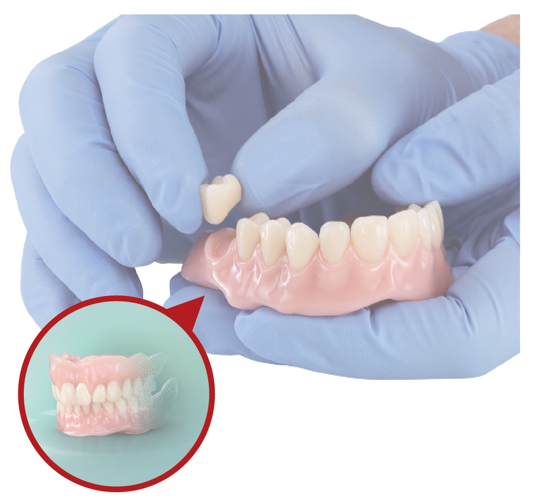 VITA VIONIC VIGO® digital denture teeth